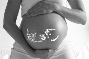 妊娠線看胎兒性別